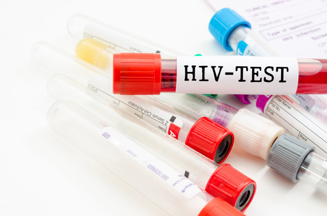 С 1 по 3 декабря в CMD можно будет бесплатно сдать анализ на ВИЧ